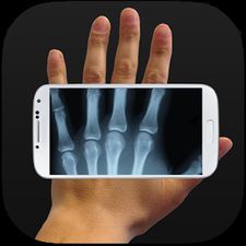 Скачать взломанную рентгеновский Шутки (Мод много денег) на Андроид
